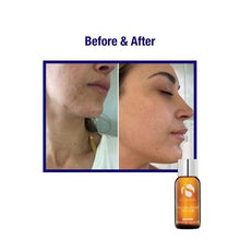 iS Clinical Pro-Heal Serum Advance+ antioxidant-rich serum containing vitamin C, E, and A for redness, rosacea, inflammation, 1 Fl Oz