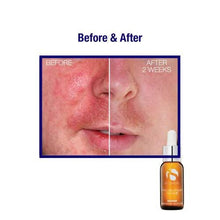 iS Clinical Pro-Heal Serum Advance+ antioxidant-rich serum containing vitamin C, E, and A for redness, rosacea, inflammation, 1 Fl Oz