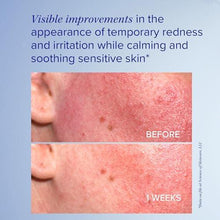 iS Clinical Pro-Heal Serum Advance+ antioxidant-rich serum containing vitamin C, E, and A for redness, rosacea, inflammation, 1 Fl Oz