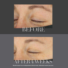 Kate Somerville KateCeuticals Lifting Eye Cream, Anti-Ageing Vitamin C Treatment, Eye Skincare, Visibly Smooths Fine Lines and Wrinkles, 15ml