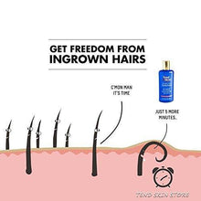 Tend Skin Ingrown Hair Solution 8oz/236 ml