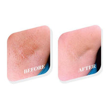 Tend Skin Ingrown Hair Solution 8oz/236 ml